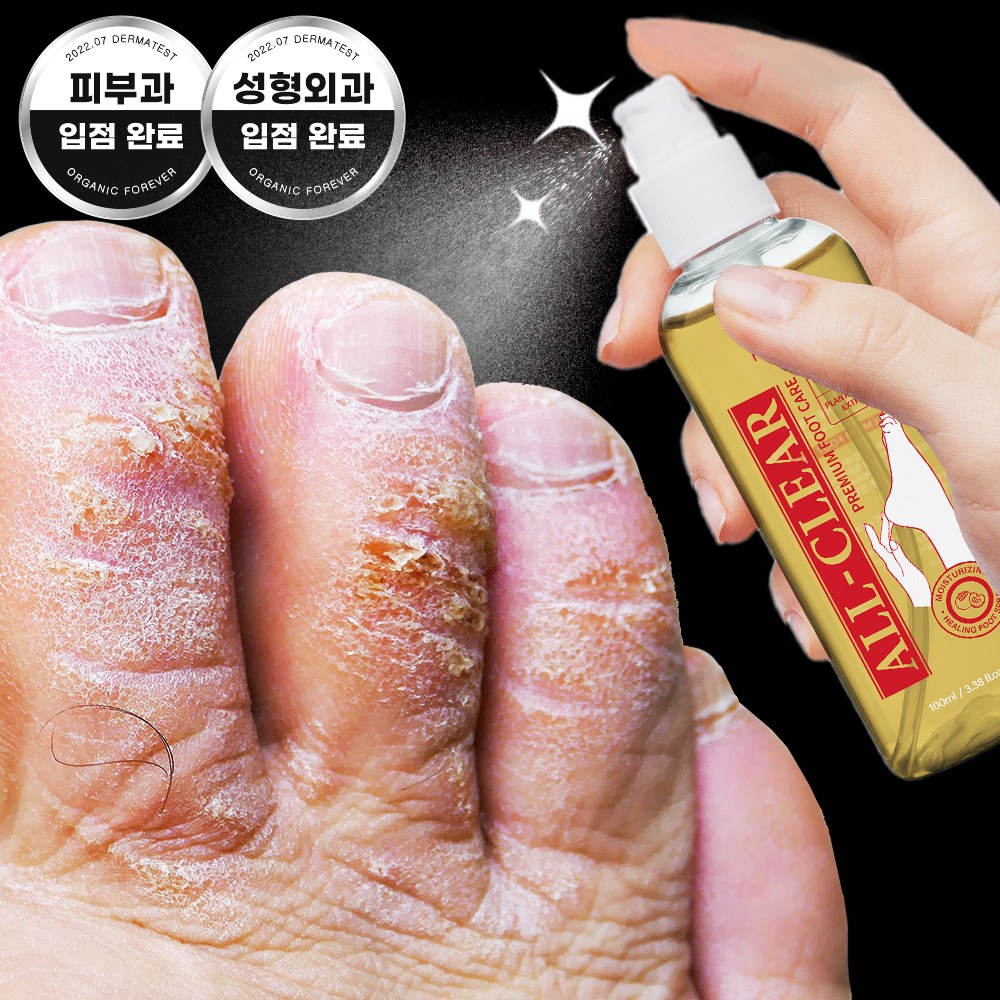 발냄새 제거 스프레이 비교 제품1